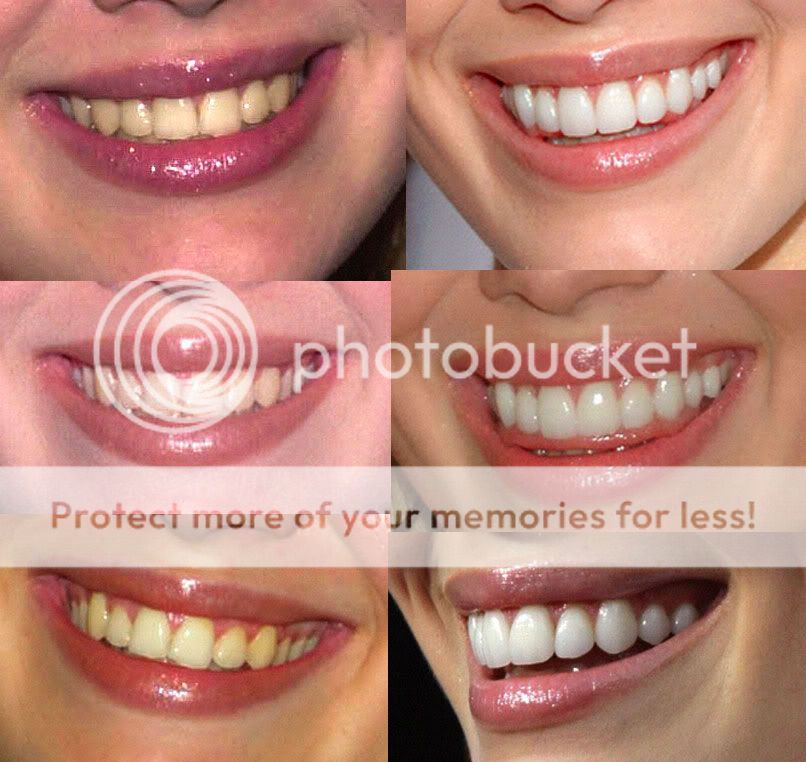 hilaryteeth.jpg