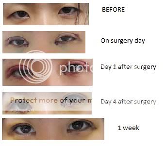 beforeafter.jpg